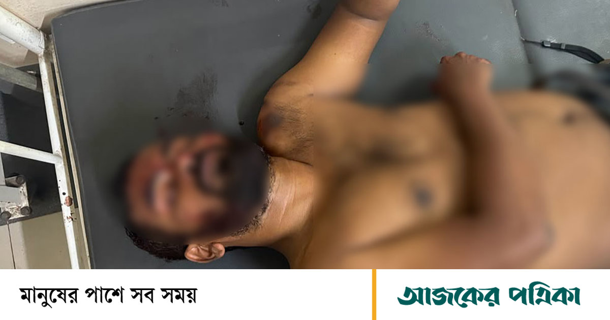 আসামি ধরতে গিয়ে ছুরিকাঘাতে এসআইসহ আহত ২ পুলিশ সদস্য