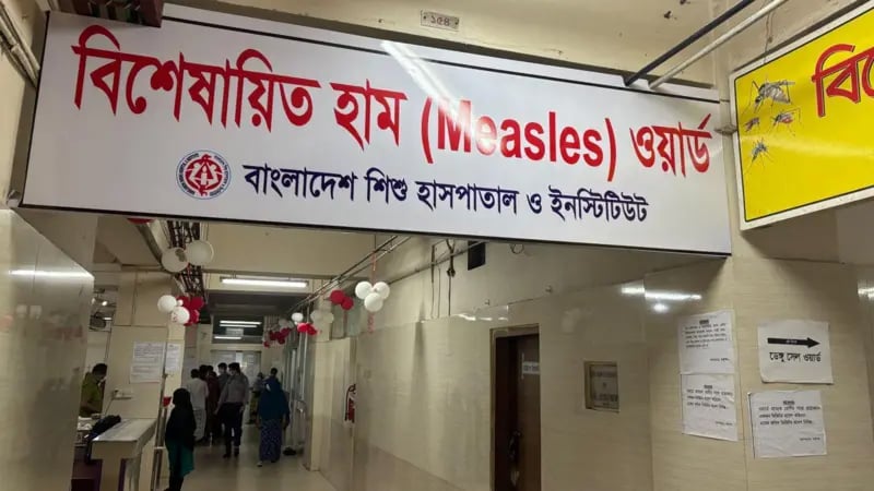 হাম ও হামের উপসর্গে মৃতের সংখ্যা ৮০০ ছাড়াল